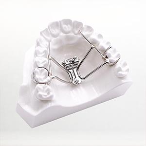 Model smile with palatal expander orthodontic appliance