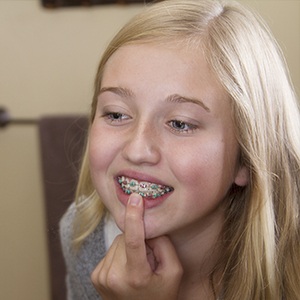 Young person pointing to something stuck in braces