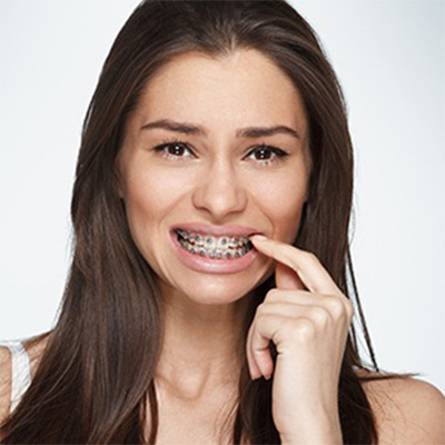 Woman pointing to loose poking braces wire