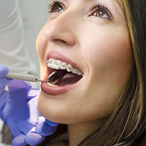 Orthodontist examining patient's loose bracket