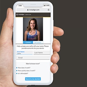 Patient using smartphone to create an online Invisalign smile simulation
