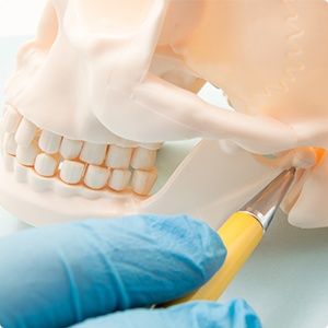 Model of jaw and skull used to demonstrate orthognathic surgery needs