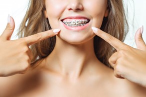 Woman with braces pointing towards her gums.